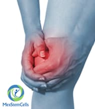 Slider image (4) MexStemCells Clinic for Chronic Degenerative Wellness